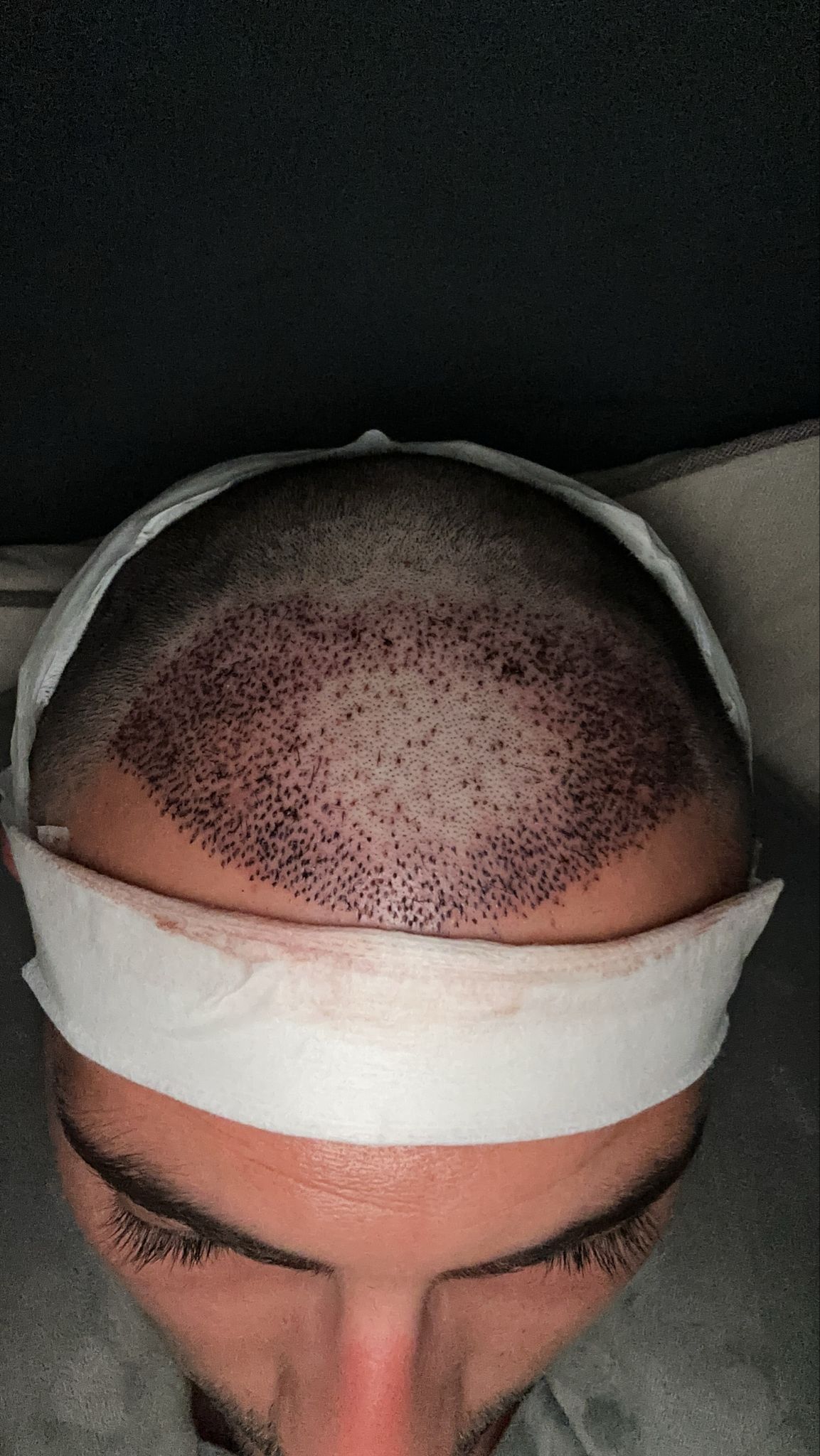 שבוע ההתקבעות - תוצאה לאחר שבוע